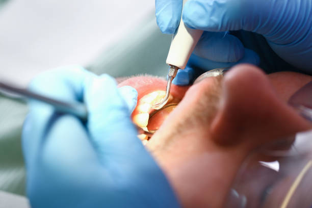 Best Cosmetic Emergency Dentistry in Peachtree Corners, GA