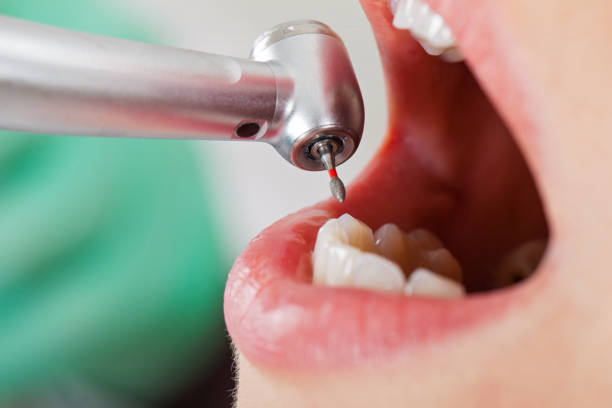 Best After-Hours Dental Trauma Care in Peachtree Corners, GA